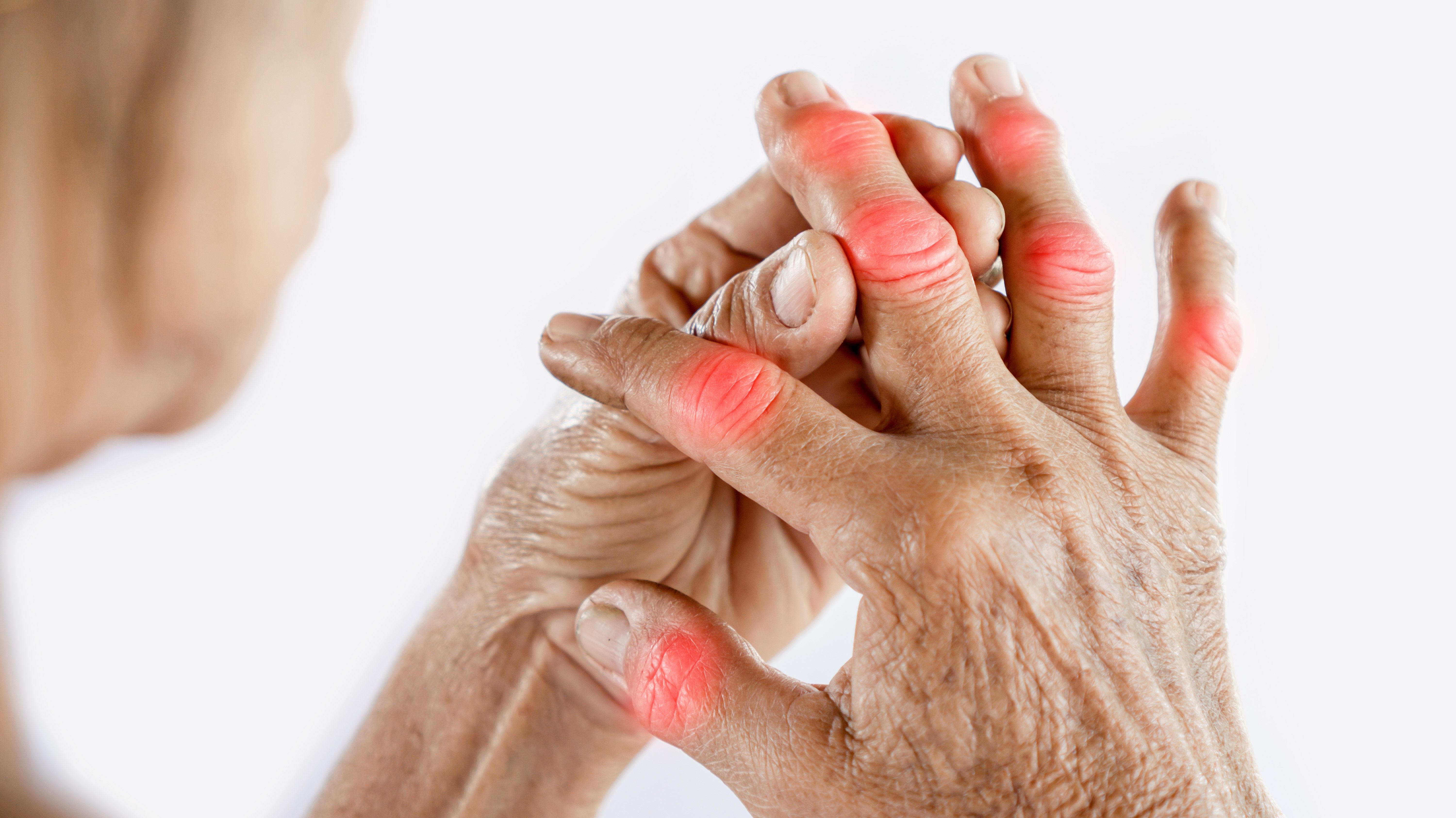 Electrohomeopathy for Arthritis & Joint Pain
