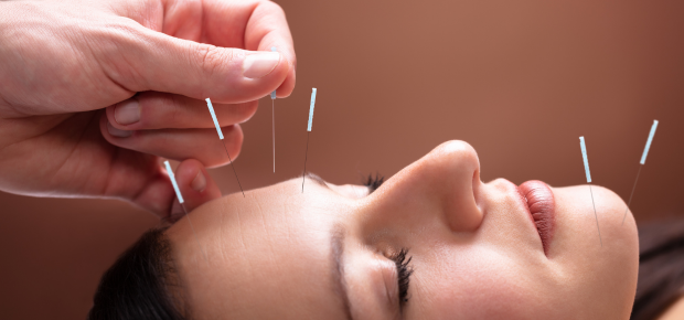 Diploma in Acupuncture - Pain Management Training